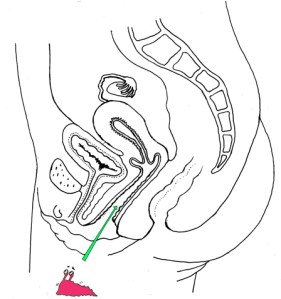 Verängstigte Nacktschnecke